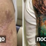 20 tattoos over scars and burns that helped people turn their blemishes into a highlight
