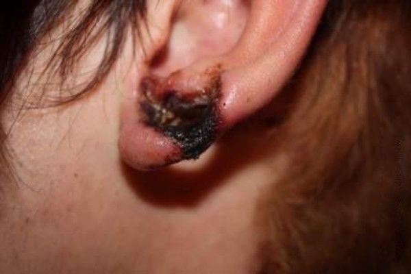 does it hurt to make tunnels in the ears