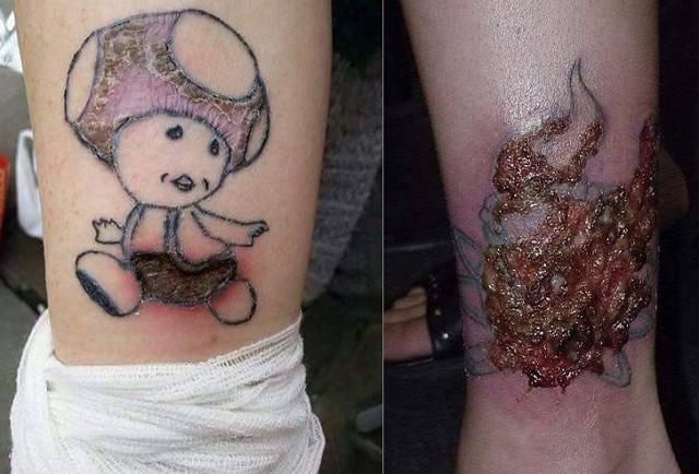 What are the dangers of tattoos