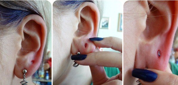How to make and tighten tunnels in the ears