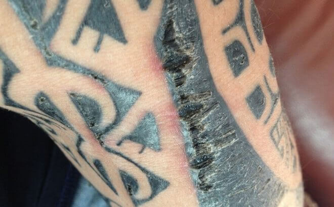 Crust on the skin after a tattoo