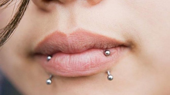 labret of the lower lip