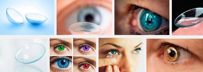 Soft contact lenses to hide eye blemishes