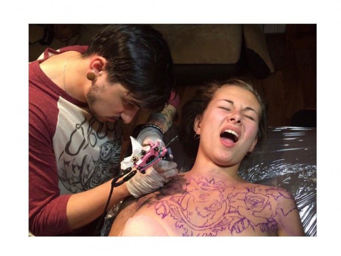 Tattooing in the breast area