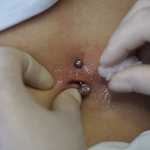 Piercing Treatment