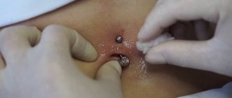 Piercing treatment