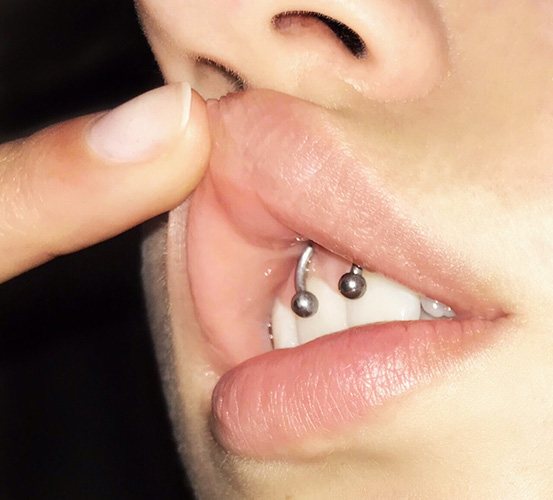 Piercing under the upper lip (smiley) on the frenulum. Photos, consequences, reviews