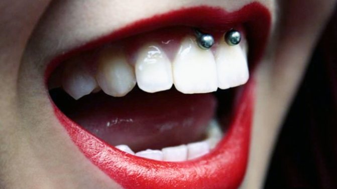Piercing under the upper lip (smile) on the frenulum. Photos, consequences, reviews