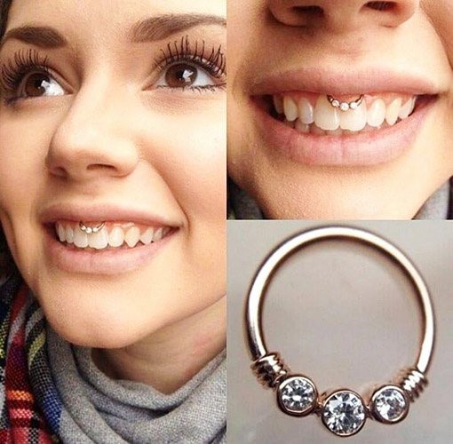Piercing under the upper lip (smile) on the frenulum. Photos, consequences, reviews