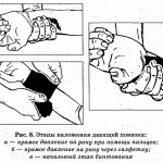 Rules of Application of a Pressure Bandage