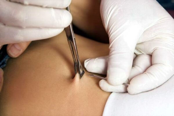 Belly button piercing procedure