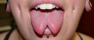 Tongue Split