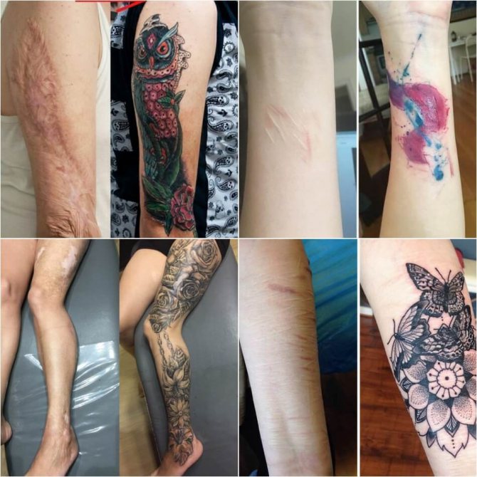 Tattoos on Scars - Tattoos on Scars - Tattoos on Scars - Cover on Scar