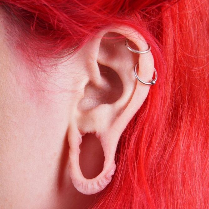 tunnels in your ears consequences