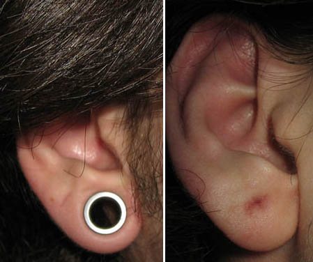 Tunnels in girls' ears. Photos, sizes of stretch marks, care.