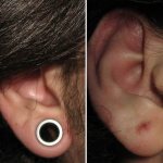 Tunnels in girls' ears. Photos, Stretch Marks Size, Care
