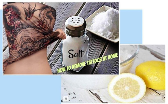 Salt Tattoo Removal