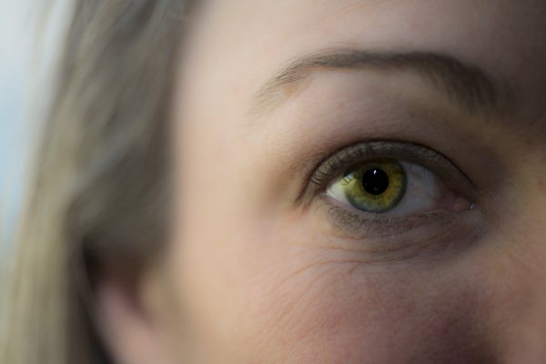 Yellow wolf eyes in humans. Photo natural, causes