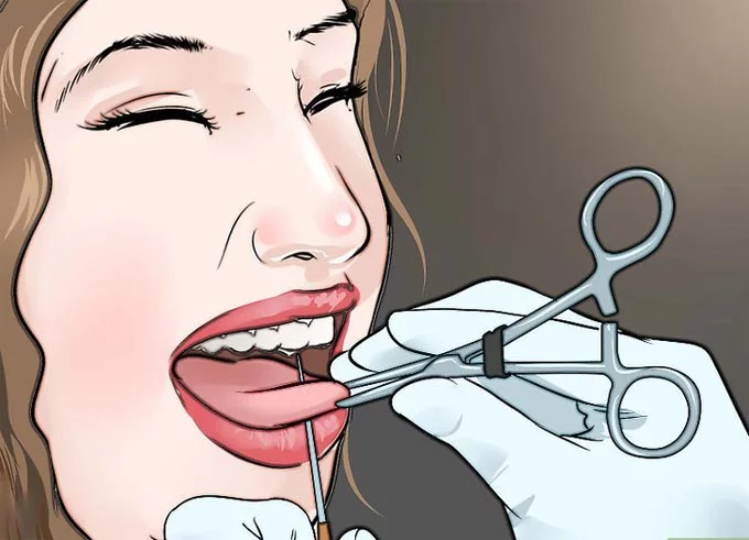 All about tongue piercing: piercing, care, possible consequences