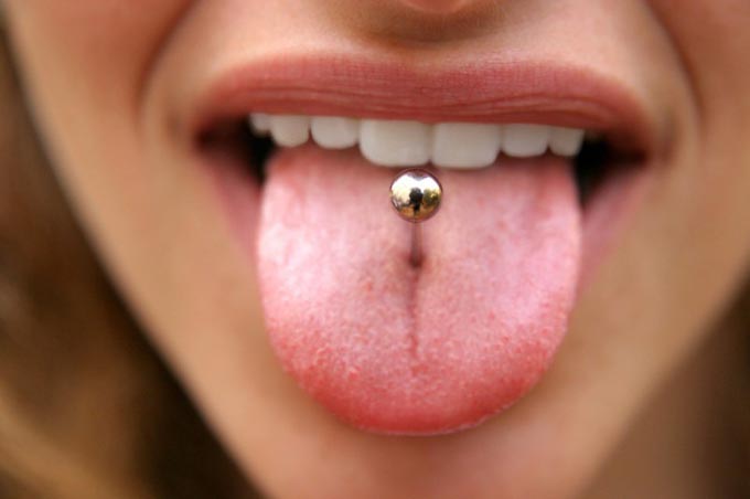 Overgrown tongue piercing