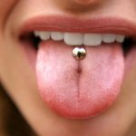 Overgrown tongue piercing
