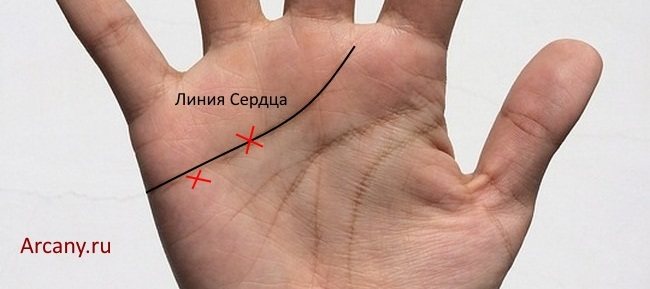 Significance of the Cross on the Palm in Chiromancy: on the Hills, fingers, lines